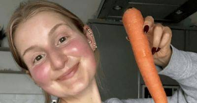 "Полезно для здоровья": девушка съела так много моркови, что кожа стала оранжевой (фото)