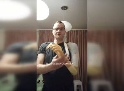 Россиянин показал протез руки, полученный бесплатно – видео