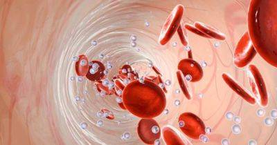 Дефицит железа: какие продукты помогут избежать анемии