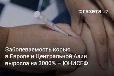 Заболеваемость корью в Европе и Центральной Азии выросла на 3000% — ЮНИСЕФ