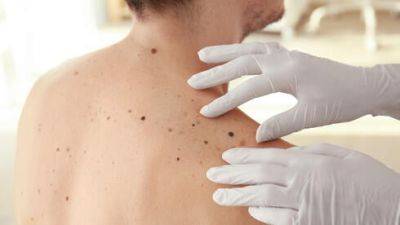Прорыв в медицине: вакцина спасает от рака кожи. Уже есть в Израиле