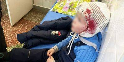 В Черниговской области под обстрел попала семья с четырехлетним ребенком, есть раненые