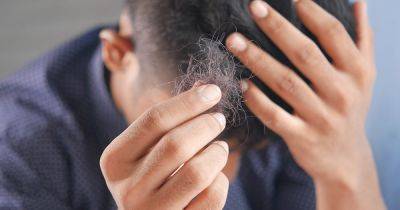 Сохранить волосы крепкими и густыми: способы лечения облысения у мужчин - focus.ua - Украина