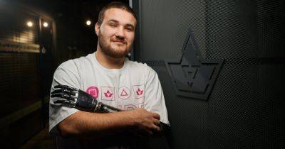 Акция "Киберпанк 2023" FAVBET помогла защитнику Бахмута получить современный бионический протез - dsnews.ua - Украина - Львов - Мариуполь