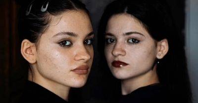 "Стали жертвой банды": девушка нашла свою сестру-близнеца благодаря видео в соцсети (фото)
