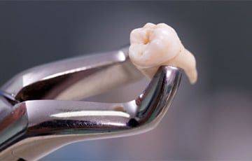 В Стамбуле мужчине удалили четыре передних зуба в стоматологии - charter97.org - Белоруссия - Стамбул