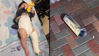 Восьмимесячный малыш пострадал при ракетном обстреле Сдерота