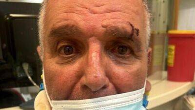 70-летнего мужчину жестоко избили в Тират-Кармеле за замечание о брошенном окурке