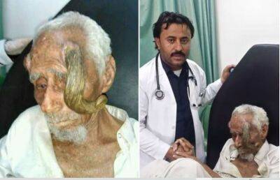 Долгожитель из Йемена умер после неудачной операции по удалению «рога»