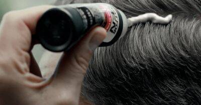 Едва не погиб: мужчина получил ожоги третьей степени после теста краски для волос (фото)