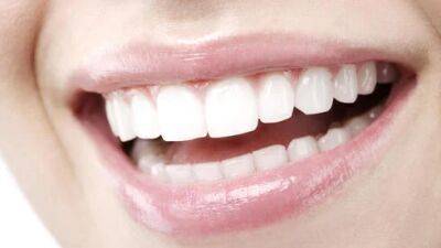 Белоснежная улыбка в день 8 марта: как отбелить зубы самостоятельно