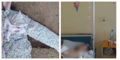 Собаки напали на мать и ребенка из-за невнимательности хозяина, кадры: "забыл закрыть дверь питомника"