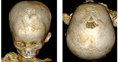 Не прожили и года. Мумии древнеегипетских детей показывают высокий уровень анемии
