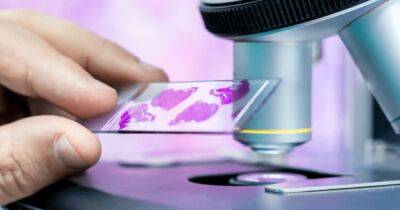 Прорывное устройство для диагностики рака анализирует образцы тканей за 30 минут