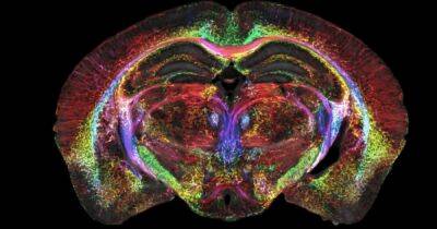 МРТ нового поколения: ученым удалось запечатлеть самые подробные в истории изображения мозга