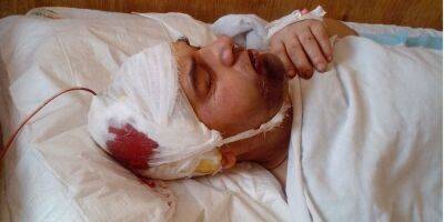 ГБР расследует избиение офицером военного в Волынской области. Ему разбили голову и сломали нос