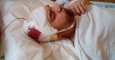 Борется за жизнь: ГБР расследует жестокое избиение раненого бойца ВСУ на Волыни (фото)