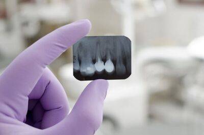 Рентген: роль в современной стоматологии и основные виды