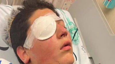 13-летний Илай может потерять глаз из-за детской шалости в Лаг ба-омер