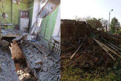 Еще больше жертв и пострадавших: оккупанты ударили по домам, школе и магазину, кадры разрушений