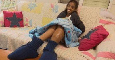Слишком огромные и тяжелые: в Австралии 11-летней девочке хотели ампутировать ступни (фото)