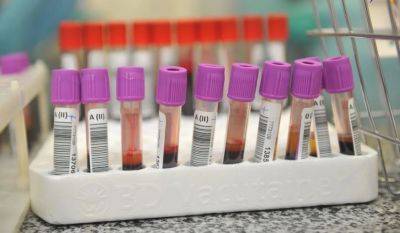 Минздрав Беларуси заявил о внедрении теста PanTum Detect, который выявляет более 60 видов рака