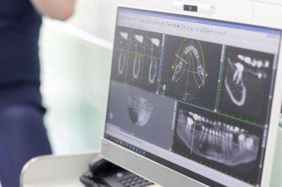 Нижегородские врачи рассказали, чем грозит потеря даже одного зуба