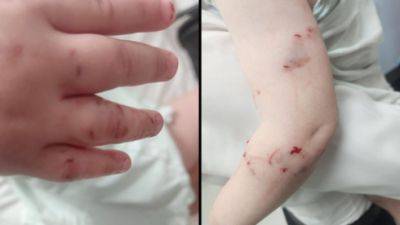 В Бней-Браке крыса искусала 2-летнюю девочку: ребенок в больнице
