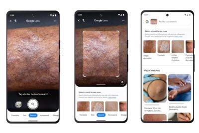 Онлайн-дерматолог. Google Lens научился распознавать заболевания кожи по фото