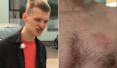 Украинский студент жалуется на нападение в рижском автосервисе
