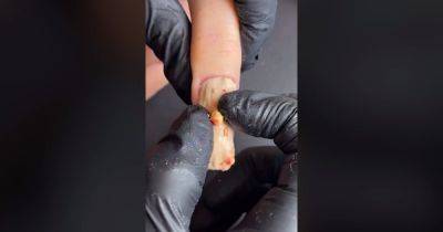 Новый тренд: салон для ногтей показал маникюр, из которого сочится искусственный гной (видео)