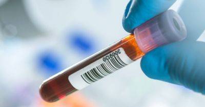 Кровавый прием. Вампирские процедуры для лица спровоцировали вспышку ВИЧ - focus.ua - Украина - штат Нью-Мексико