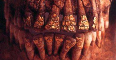 Древняя стоматология была дорогой: о чем рассказал старинный череп с золотыми зубами