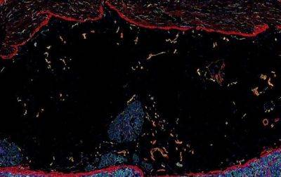 Ученые показали подробную карту человеческого кишечника