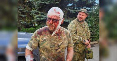 Бывший лидер донбасских боевиков бородай ранен в результате обстрела ВСУ (фото)