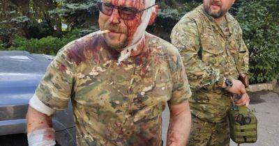 Обстреляли под Бахмутом: соратник Гиркина Бородай получил серьезные ранения (фото)