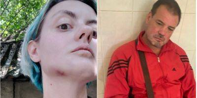 В Ужгороде пьяный сотрудник ТЦК избил женщину: в Минобороны и МВД отреагировали