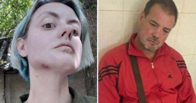 "Ты воевал, или с**бался?": в Ужгороде пьяный военком избил жену бойца (фото)