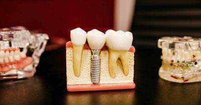 Без пломб и штифтов. Ученые научились заново отращивать здоровые зубы