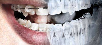 Нейросеть способна с точностью до 94% определять пол людей по рентгеновским снимкам зубов