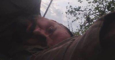 Лежал на земле и говорил с трудом: Сенцов получил контузию на фронте (видео)
