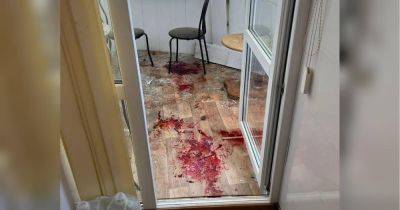 Оккупанты ударили по больнице в Херсоне, погиб врач (фото)