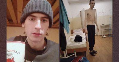 "Я был в аду": история парня с шизофренией, которого оккупанты в Мелитополе пытали месяцами