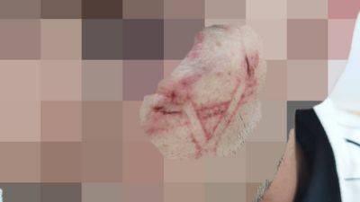 Жалоба: полицейские нацарапали магендавид на щеке арестованного араба