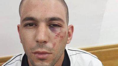 Клеймо на лице: полиция Израиля не должна превратиться в путинский ОМОН