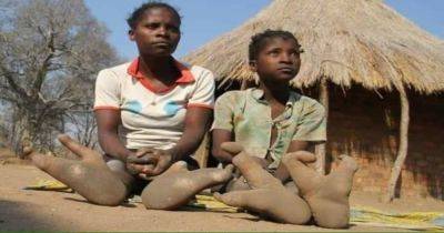 "Клешни омара": загадка людей племени Вадома, у которых ноги похожи на страусиные (фото)