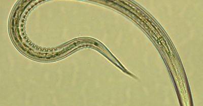 Первое испытание на людях: кишечные черви-паразиты успешно предотвращают диабет 2 типа (фото)