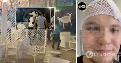 Россияне в Турции – в Турции избили россиян стульями по голове – видео