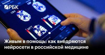Живым в помощь: как внедряются нейросети в российской медицине