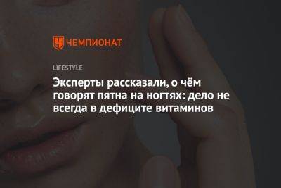 Эксперты рассказали, о чём говорят пятна на ногтях: дело не всегда в дефиците витаминов